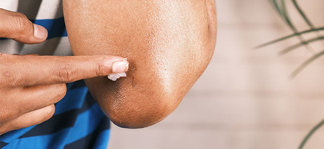 Persona echandose crema en el codo